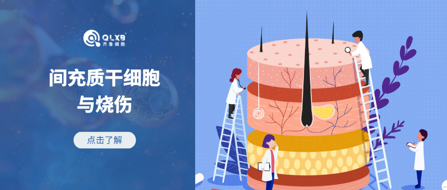 科普日常 | 间充质干细胞在烧伤领域的应用前景